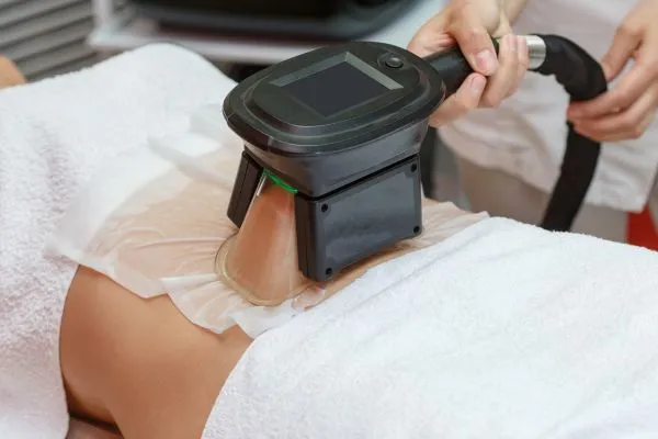 Image of person having fat freezing treatment to help weight gain Falkirk