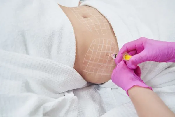 image of fat dissolving injections on love handles to help combat weight gain Falkirk