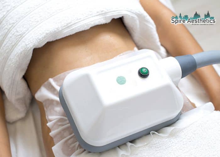 Shift Those Extra Pounds: How Fat Freezing Can Help You Slim Down Falkirk