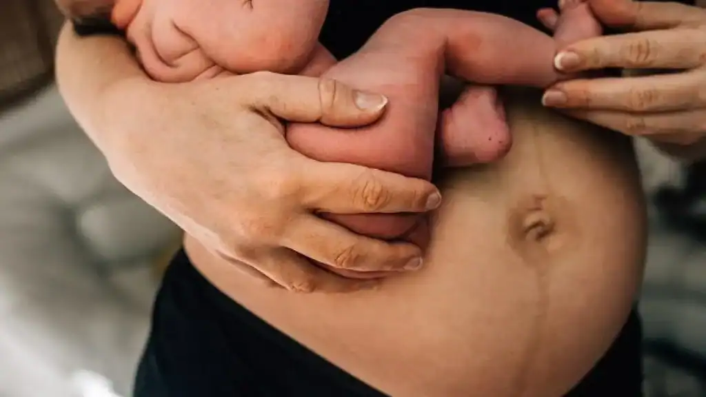 Why Is My Stomach Still Big After Pregnancy Falkirk?