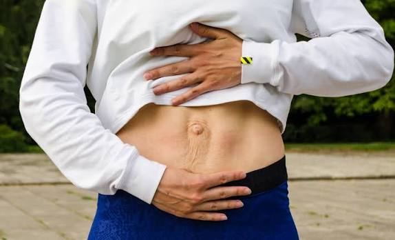 When Could Diastasis Recti Be the Missing Piece of the Puzzle Falkirk?